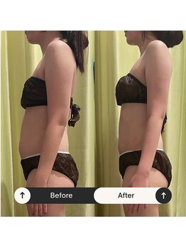 カルナ(CARNA)/最強トリプル痩身ケア