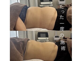 リ クリニカル ラボ(Re clinical Labo)の写真/今話題の赤岩式腸削り“最難関技術を使ってぽっこりお腹/便秘解消/血行促進/腰痛
一度で効果を実感♪