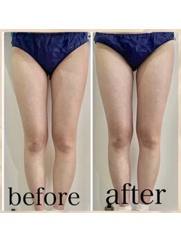 エンチャント(ENCHANT)/太もものぷにっと感なくしたい！