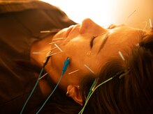 マタタビ(mata-tabi)/しっかりたるみケアの美容鍼灸