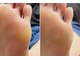 イーデザイン ネイル(E.design.Nail)の写真/どんな時でも自信の持てる素足に♪足の裏のザラつきやかかとのガザガザは当店のフットケアにお任せ◎