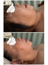 メディカルエステ ユウ(Yuu)/