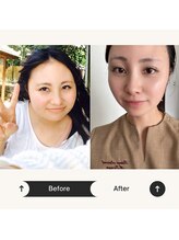 リノン(LIINON)/LIINON オーナー　before after