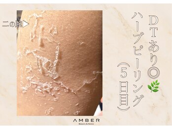 アンバー 恵比寿(AMBER)/DT有ハーブピーリング