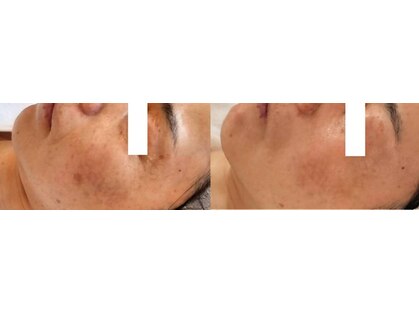 リセル(RE.cell)の写真