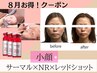 【8月限定】とにかく小顔になりたーい！最強コンボ人気機器×レッドショット