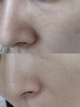 ビーユー(Be.you)/敏感肌の方もOK☆