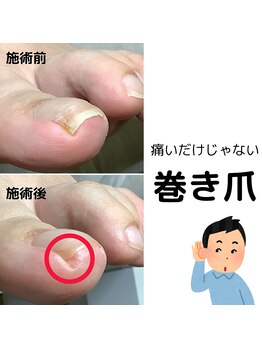 リゼラアンドコー 宇都宮店/