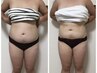 【1番お得！】とにかく早く結果を出したい！水素まみれコース¥9800→¥8840