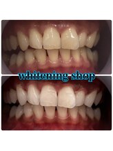 ホワイトニングショップ 倉敷店/