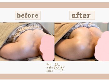 アンド ワイ(&y)/30代／出産歴あり