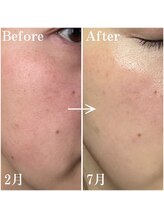 ミチル(mi-chill)/触り方を変えただけで！