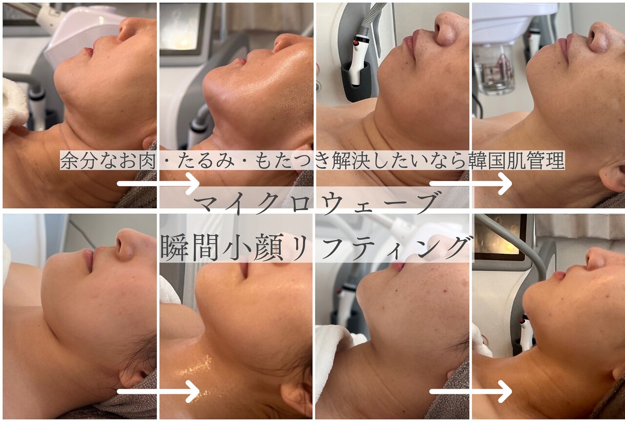 リリー(LILY)｜ホットペッパービューティー