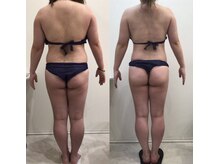 ルシアル 新宿代々木店(LUCIAL)/痩身オーダーメイド