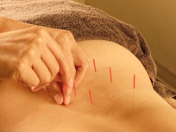 柿沼治療院の写真/【全室個室】アットホーム空間でリラックスしながら受けられる♪指圧/スポーツマッサージ/鍼灸/妊活/産後