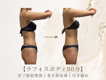 アネラボーテ(Anela Beaute)/ラフォスボディ90分