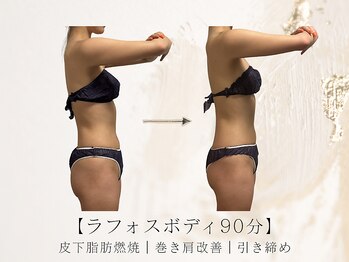 アネラボーテ(Anela Beaute)/ラフォスボディ90分