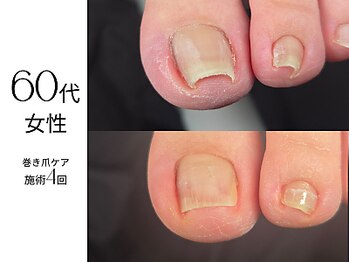 爪の向きも変わってきてる?!