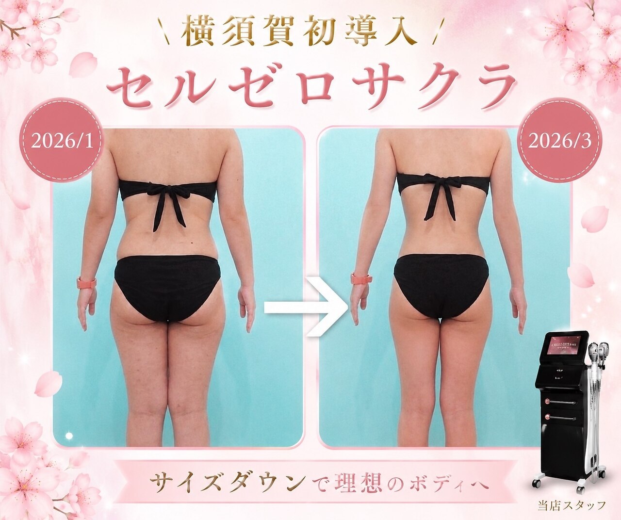 セルフビューティー 横須賀店｜ホットペッパービューティー