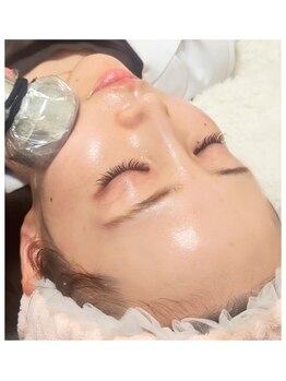 ナナイロ(nanairo)の写真/大分で1台しかない最新小顔マシン【マイクロリフト/脂肪分解】導入店。瞬間小顔を手に入れたい方にオススメ