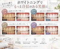 ホワイトニングショップ 立川店