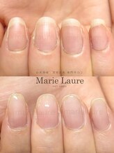 マリーロール 淀屋橋本店(Marie Laure)/自爪育成/深爪矯正/ネイルケア