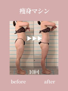 ハナメ(HANAME)/全身一回り引き締まります!