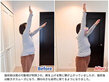 ラシュシュ/ビフォーアフター