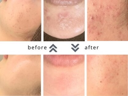 美顔研究所 バイ ヴィヴセカンド(美顔研究所 by viv 2nd)の写真