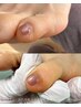 【サンダルの時期に向けて】トータルフットネイルケア7,500円