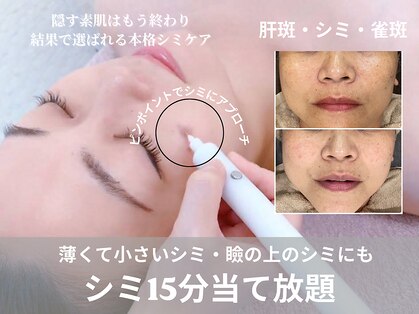 テセラ(Tethere)の写真