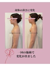 風薫(フウカ)/二の腕│ビフォーアフター