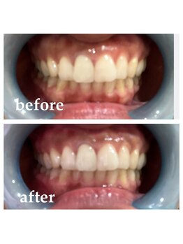 ホヌ ルアナ(Honu Luana)/