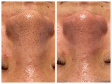 アヴィジョン(Avision)/