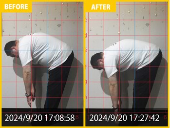 整体院 元 宇城松橋店/腰痛と下肢の痺れ