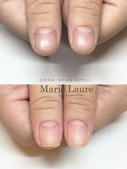 マリーロール 淀屋橋本店(Marie Laure)/自爪育成/深爪矯正/ネイルケア