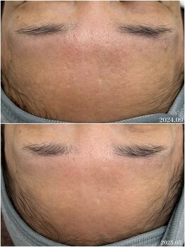 ヒルナム(Heal Nam)/~プロセルセラピーズお顔~