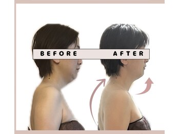 ワ(Wa)/美容整体変化