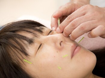 青井三丁目鍼灸整骨院の写真/【美容鍼×姿勢矯正】プロの施術で肌質改善&美姿勢へ◎骨盤・関節から整えて、内側から輝く美しさを！