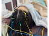 【頭皮鍼で脳疲労・眼精疲労/頭痛・不眠/抜け毛　】ニードルヘッドスパ 45分