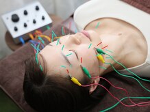 ふらみんご鍼灸整骨院/電気を流す美容鍼