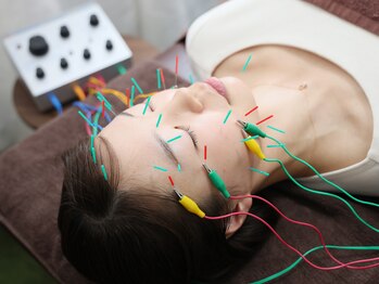 ふらみんご鍼灸整骨院/電気を流す美容鍼
