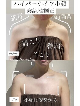 レシェルサロン(Lechelle Salon)/ハイパーナイフ＋全身矯正