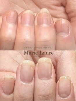 マリーロール 梅田店(Marie Laure)/自爪育成/深爪矯正/ネイルケア