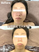 エリーザベル(Elisa Bell)/小顔矯正コルギ