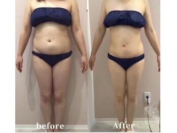 セカンドハウス(Second house)/ビフォーアフター(N様)