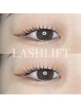 スイ(SUI)/重ためまぶたさんでもぱっちりと