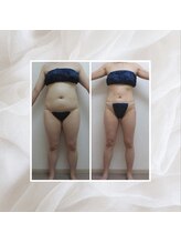 プリマプリート 名駅店/エンダモロジー