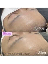 レディエント 北浦和店(Radiant)/額ワックス