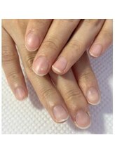 ニーナ(nina)/施術前